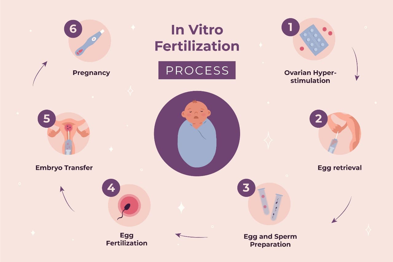 The In-Vitro Fertilization Process